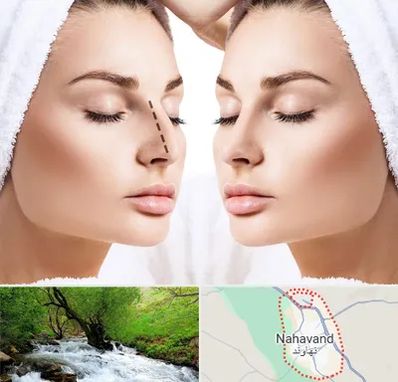 عمل بینی در نهاوند