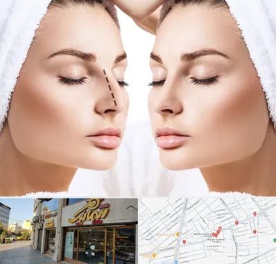 عمل بینی در عطاران قم