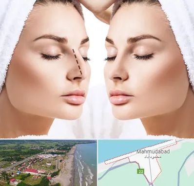 عمل بینی در محمودآباد