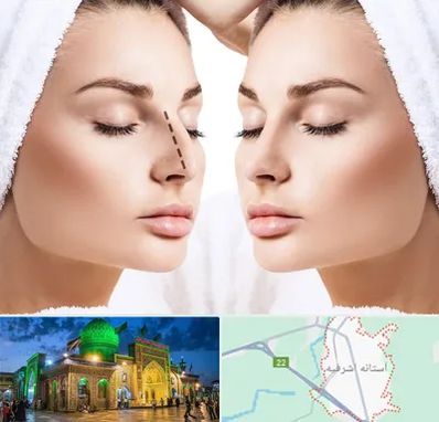 عمل بینی در آستانه اشرفیه