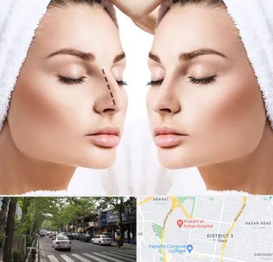 عمل بینی در ظفر