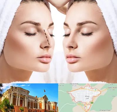 عمل بینی در خوی