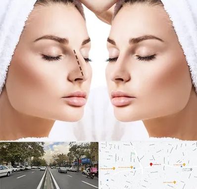 عمل بینی در دولت