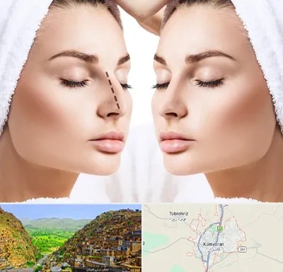 عمل بینی در کامیاران