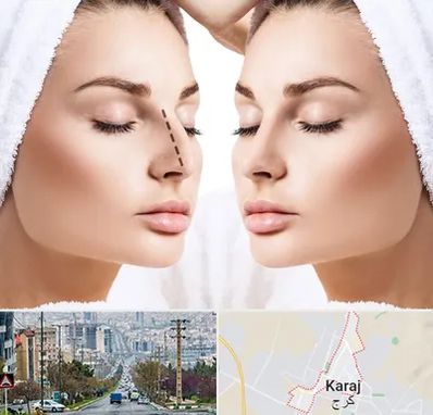 عمل بینی در گوهردشت