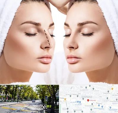 عمل بینی در میرداماد