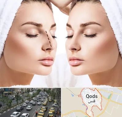 عمل بینی در شهر قدس