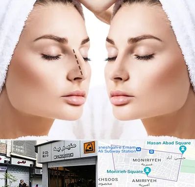 عمل بینی در منیریه