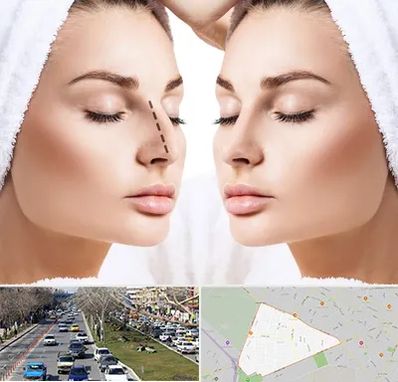 عمل بینی در احمدآباد مشهد