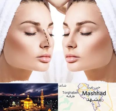 عمل بینی در مشهد