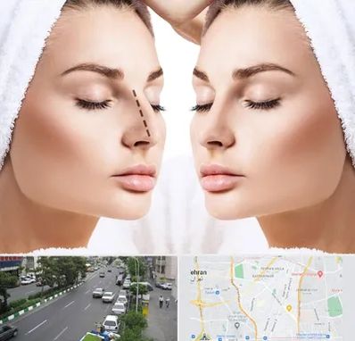 عمل بینی در ستارخان