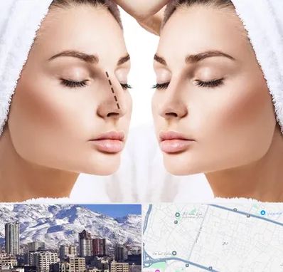 عمل بینی در ازگل