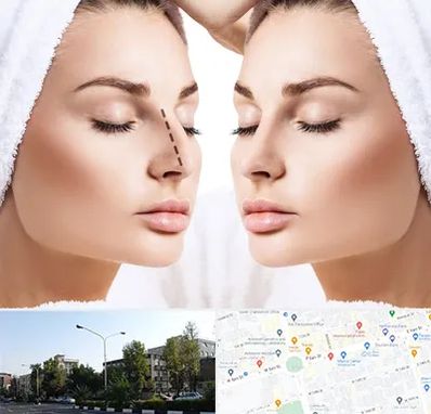 عمل بینی در میدان کاج