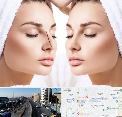 عمل بینی در پیروزی