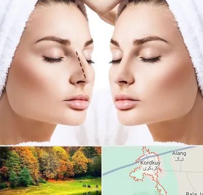 عمل بینی در کردکوی