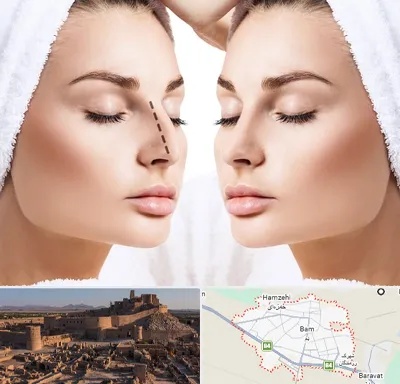 عمل بینی در بم