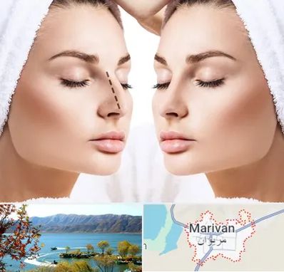عمل بینی در مریوان