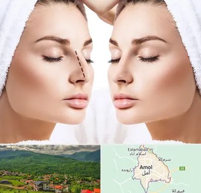 عمل بینی در آمل