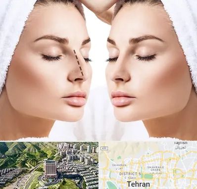 عمل بینی در شمال تهران