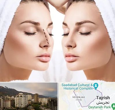 عمل بینی در زعفرانیه