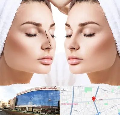 عمل بینی در نصف راه تبریز