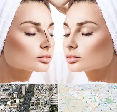 عمل بینی در منطقه 18 تهران