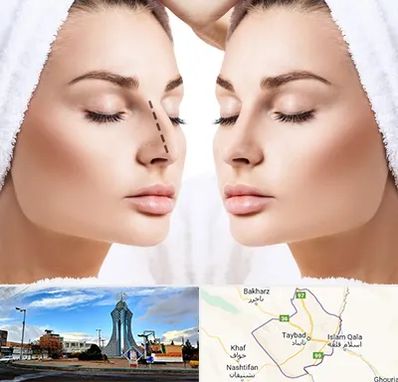 عمل بینی در تایباد