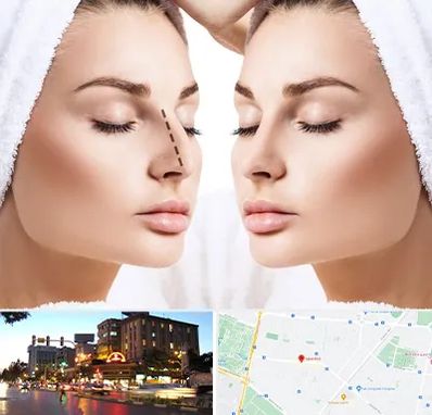 عمل بینی در بلوار سجاد مشهد