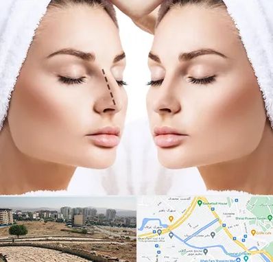 عمل بینی در کوی وحدت شیراز