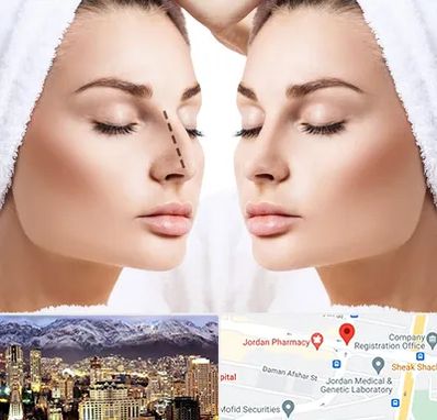 عمل بینی در جردن