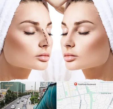 عمل بینی در بلوار فرحزادی