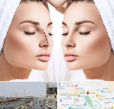 عمل بینی در بلوار توس مشهد