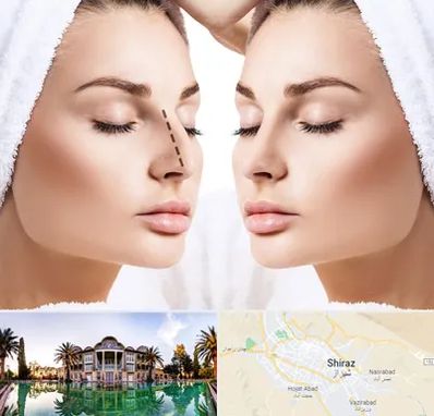 عمل بینی در شیراز
