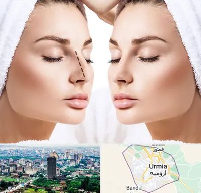 عمل بینی در ارومیه