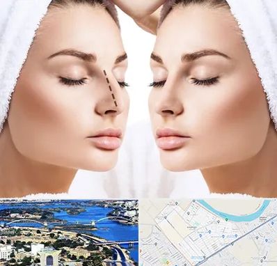 عمل بینی در کوروش اهواز