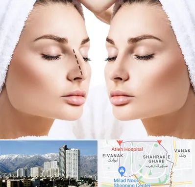 عمل بینی در شهرک غرب تهران