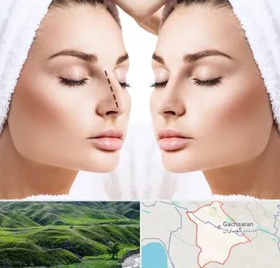 عمل بینی در گچساران