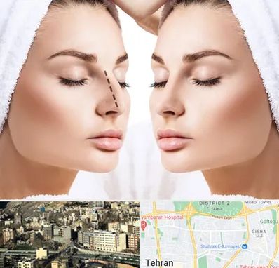 عمل بینی در مرزداران