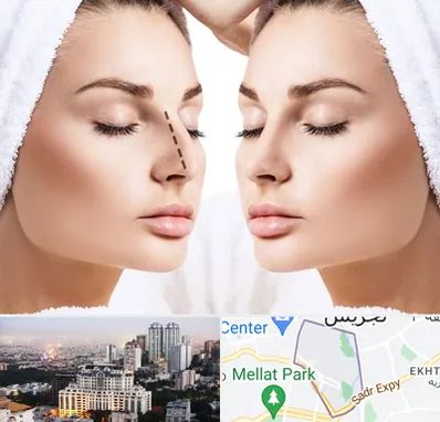 عمل بینی در الهیه