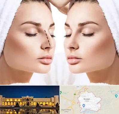 عمل بینی در برازجان