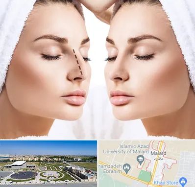 عمل بینی در ملارد