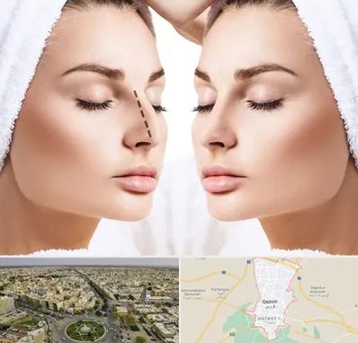 عمل بینی در قزوین