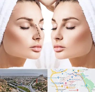 عمل بینی در معالی آباد شیراز