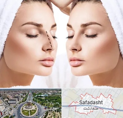 عمل بینی در صفادشت