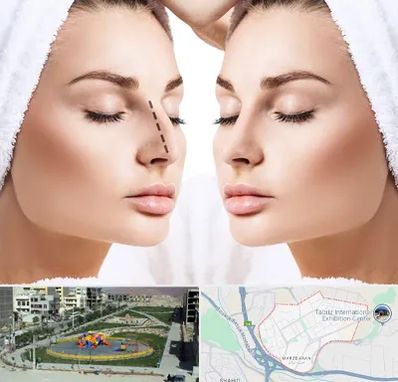 عمل بینی در مرزداران تبریز