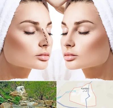 عمل بینی در کردان