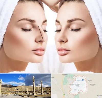 عمل بینی در مرودشت