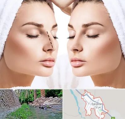 عمل بینی در سراوان