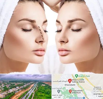 عمل بینی در قصرالدشت شیراز