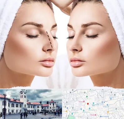 عمل بینی در میدان شهرداری رشت